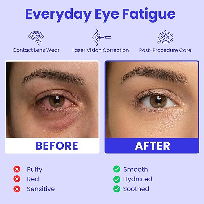 Luméa™ Steam Eye Mask